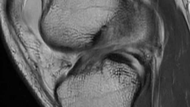 Donald L. Resnick, M.D., Presents... Internal Derangement of Joints: Pelvis and Lower Extremity - A Video CME Teaching Activity