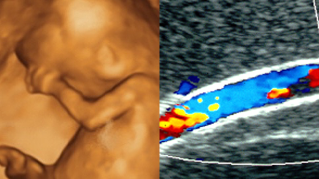 Classic Lectures in Ultrasound - A CME Teaching Activity