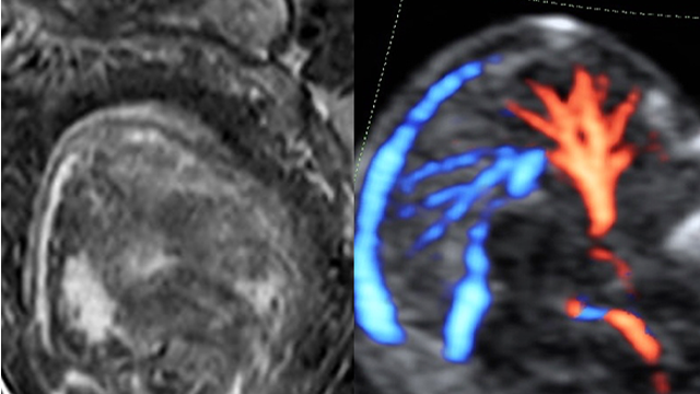 Classic Lectures in Women’s Imaging - A Video CME Teaching Activity